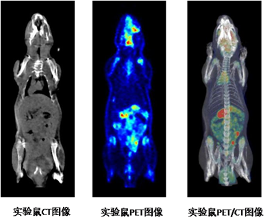 PET-CT成像 PET-CT成像